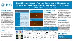 Greta Gregg, OD Rapid Progression of Primary Open Angle Glaucoma in Adult Male Associated with Prolonged Postural Change