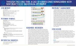 D'Ajanee Smallwood, OD,MS Through Thick and Thin: A Case of Keratoconus Management with Fuchs’ Endothelial Dystrophy