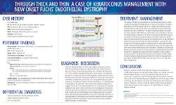 Through Thick and Thin: A Case of Keratoconus Management with Fuchs’ Endothelial Dystrophy