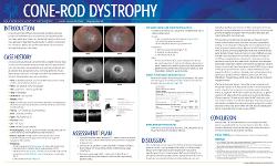 Jennifer Jones, OD Cone-Rod Dystrophy