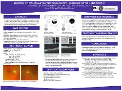 History of Malignant Hypertension with Ischemic Optic Neuropathy