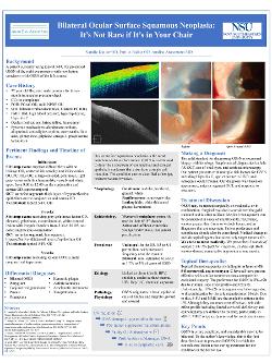 Natalie Duider, OD Bilateral Ocular Surface Squamous Neoplasia: It's Not Rare If It's in Your Chair