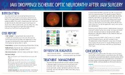 Madison Angell, OD Jaw dropping! Ischemic optic neuropathy after jaw surgery