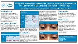 Reneta Simeon, BS Management of Bilateral Eyelid Ptosis using omymetazoline hydrochloride in a Patient with CPEO Following Failed Surgical Ptosis Repair