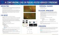 Foster-Kennedy Syndrome and Pseudo-Foster-Kennedy Syndrome: Diagnosis, Treatment, Management