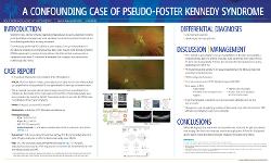 Sylvia Sparrow, OD Foster-Kennedy Syndrome and Pseudo-Foster-Kennedy Syndrome: Diagnosis, Treatment, Management