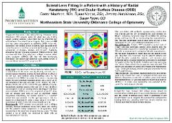 Scleral Lens Fitting in a Patient with a History of Radial Keratotomy (RK) and Ocular Surface Disease (OSD)