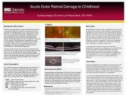Karrissa Siegel, OD Acute Outer Retinal Damage in Childhood