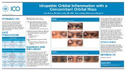 Idiopathic Orbital Inflammation with Concomitant Orbital Mass