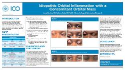 Luke Rockne, OD Idiopathic Orbital Inflammation with Concomitant Orbital Mass