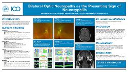 Bilateral Optic Neuropathy as the Presenting Sign of Neurosyphilis