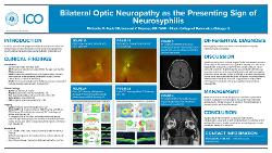 Michaella Ford, OD Bilateral Optic Neuropathy as the Presenting Sign of Neurosyphilis