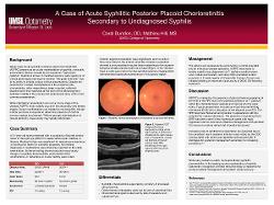 Coral Dundon, OD A Case of Acute Syphilitic Posterior Placoid Chorioretinitis Secondary to Undiagnosed Syphilis