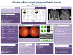 Maggie Pohlmeier, OD Acute vision loss leads to diagnosis of rare malignant histiocytosis