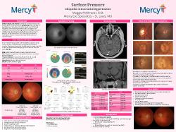 IDIOPATHIC INTRACRANIAL HYPERTENSION