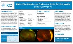 Clinical Manifestations of Proliferative Sickle Cell Retinopathy