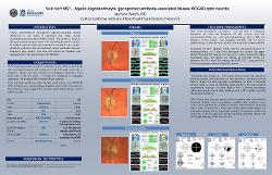 Jasmine Welch, OD So it isn't MS?... Myelin oligodendrocyte glycoprotein antibody-associated disease (MOGAD) Optic Neuritis