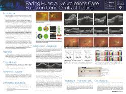 Fading Hues: A Neuroretinitis Case Study on Cone Contrast Testing