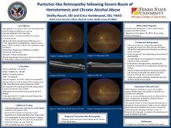 Shelby Rauch, OD Purtscher-like Retinopathy following Severe Bouts of Hematemesis and Chronic Alcohol Abuse