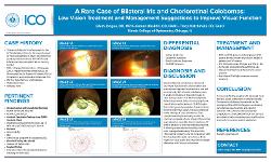 Edem Jongue, OD,MPH A Rare Case of Bilateral Iris and Chorioretinal Colobomas: Low Vision Treatment and Management Suggestions to Improve Visual Function