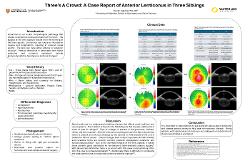 Three's A Crowd: A Case Report of Anterior Lenticonus in Three Siblings