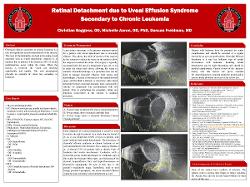 Christian Boggess, OD Retinal Detachment due to Uveal Effusion Syndrome Secondary to Chronic Leukemia