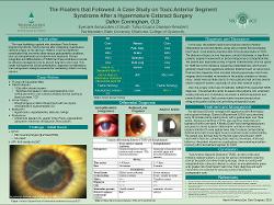 Dalton Cunningham, OD The Floaters that Followed: A Case Study on Toxic Anterior Segment Syndrome After a Hypermature Cataract Surgery