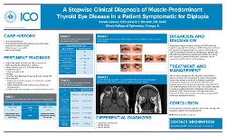 Reneta Simeon, OD A Stepwise Clinical Diagnosis of Muscle-Predominant Thyroid Eye Disease in a Patient Symptomatic for Diplopia