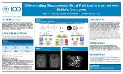 Stephen Sanabria, BS Differentiating Glaucomatous Visual Field Loss in a Patient with Multiple Aneurysms