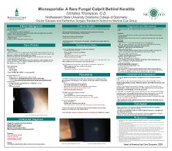 Christina Thompson, OD Unmasking the Mystery: Vittaforma Ocularum – A Rare Fungal Culprit Behind Keratitis
