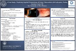 Jazmine Casias, OD A Case Study: Exploring Atypical Presentations of Ocular Tuberculosis with Laboratory Testing