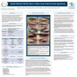 Staph Infection Strikes Back: A Rare Case of Giant Fornix Syndrome