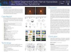 Superior Segmental Optic Nerve Hypoplasia aka Topless Disc Syndrome