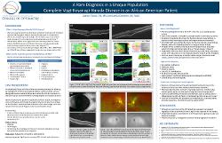 Zachary Turple, OD,MS A Rare Diagnosis in a Unique Population: Vogt-Koyanagi-Harada Disease in an African American Patient