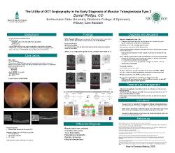 Daniel Phillips, OD The Utility of OCT Angiography in the Early Diagnosis of Macular Telangiectasia Type 2
