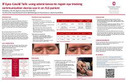 Shihij Takoo, OD,MS If Eyes Could Talk: using scleral lenses to regain eye-tracking communication device use in an ALS patient