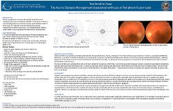 Bhavna Joshi, OD Too Small to Fuse: The Key to Diplopia Management Associated with Loss of Peripheral Fusion Lock