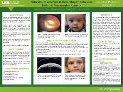 Melissa Kontos, OD Scleral Lens as a Path to Tarsorrhaphy Release in a Pediatric Neurotrophic Keratitis Case