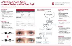 A “Little Lady” with Adie’s: a case of Pediatric Adie’s Tonic Pupil