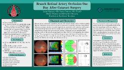 Retinal Artery Occlusion: A Rare but Serious Sequel to Cataract Surgery