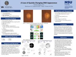 A Case Of Quickly Changing ONH Appearance