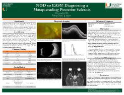 NOD so easy! Diagnosing a Masquerading Posterior Scleritis