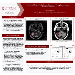 Macy Koepke, OD Incidental Occipital Lobe Lesion Discovered During Postoperative Cataract Extraction