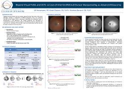Maria (MJ) Bustamante, OD,MS Beyond Visual Fields and OCTs: A Case of Inherited Retinal Disease Masquerading as Advanced Glaucoma