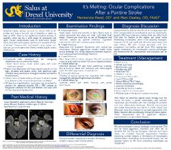 It’s Melting: Ocular Complications After a Pontine Stroke