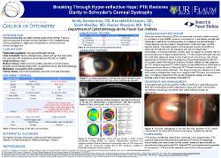 Emily Zimmerman, OD Breaking Through Hyper-reflective Haze: PTK Restores Clarity in Schnyder's Corneal Dystrophy