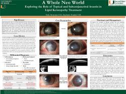 Neha Srinivasan, OD A Whole Neo World: Exploring the Role of Topical and Subconjunctival Avastin in Lipid Keratopathy Treatment
