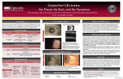 Conjunctival CIN-drome: the Good, the Bad, and the Squamous