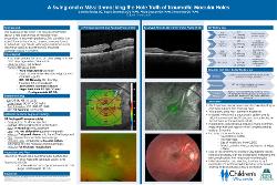 Swing and a Miss: Unmasking the Hole Truth of Traumatic Macular Holes
