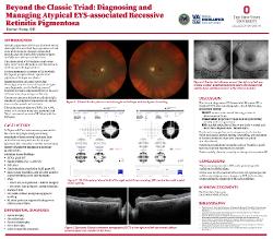 Darren Vong, OD Beyond the Classic Triad: Diagnosing and Managing Atypical EYS-associated Autosomal Recessive Retinitis Pigmentosa